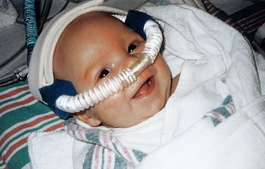 cpap-machine-to-save-lives-of-newborns