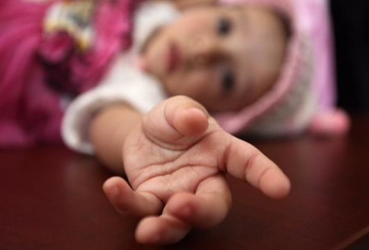 Children-in-Yemen-at-risk-for-Epidemic