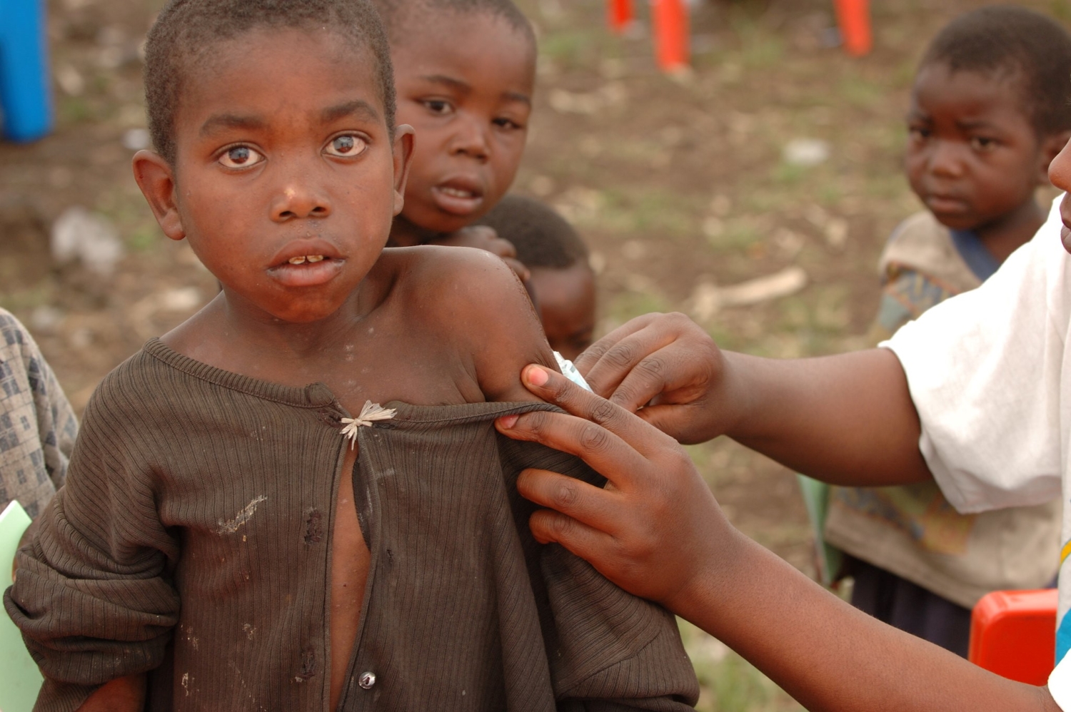 what-is-the-cost-of-measles-in-the-developing-world-the-borgen-project