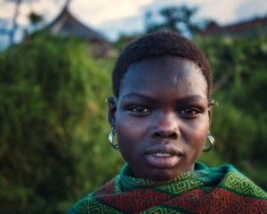 Endometriosis in Uganda