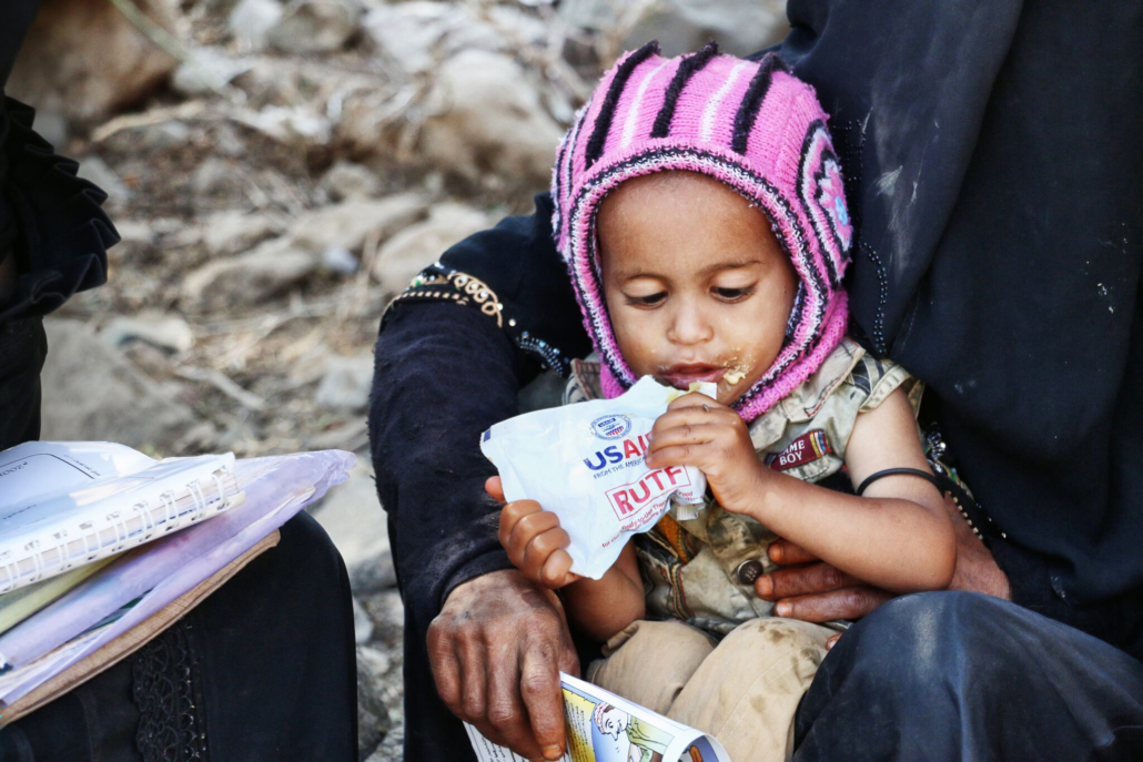 Hunger in Yemen