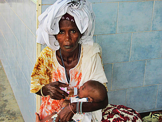 Impact-of-Malnutrition-in-Guinea-Bissau