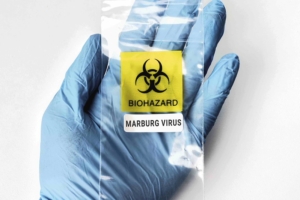 Marburg Virus in Ethiopia