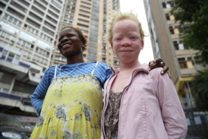 People With Albinism in Malawi