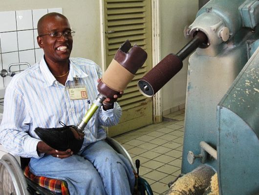 Prosthetic-Devices-in-Developing-World