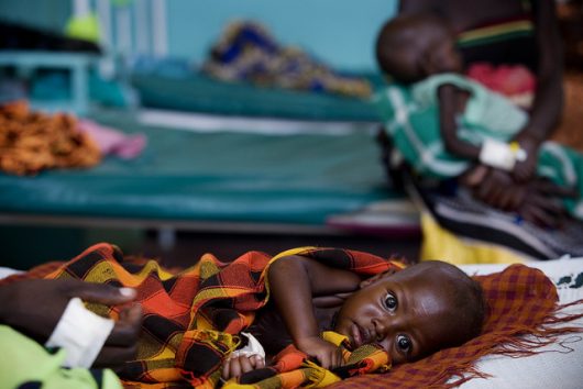 Hunger In Zimbabwe Overcoming Child Malnutrition